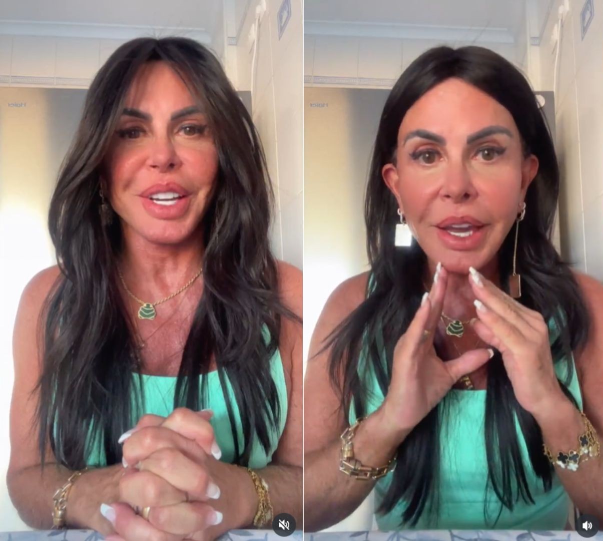 gretchen procedimentos esteticos