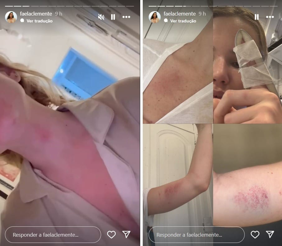 Ex-namorada de Dado Dolabella, Marcella Tomaszewski, formaliza denúncia após agressões marcela tomaszewski