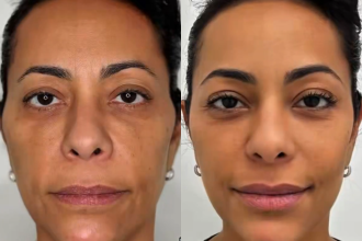 Samantha Schmutz surpreende fãs após transformação com médico das Kardashians Design sem nome 2025 12 09T104617.221