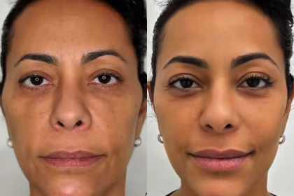 Samantha Schmutz surpreende fãs após transformação com médico das Kardashians Design sem nome 2025 12 09T104617.221