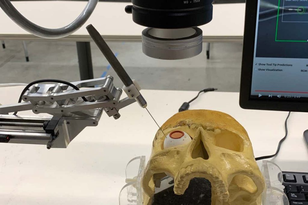 Robô com inteligência artificial realiza cirurgia de retina e abre caminho para microcirurgias autônomas SEI 162907562