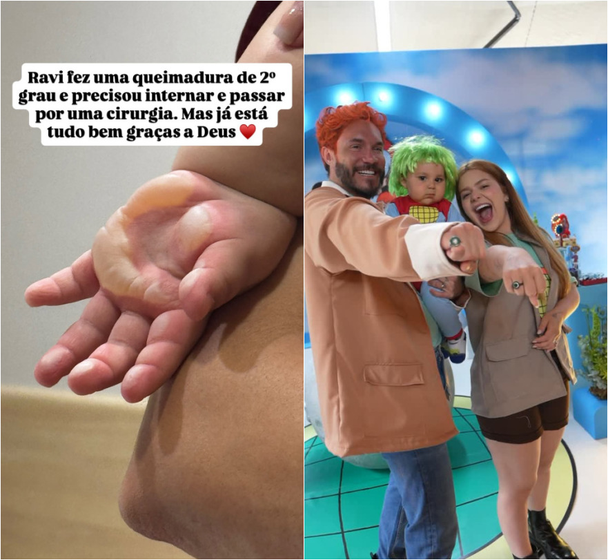 Filho de Viih Tube e Eliezer sofre queimadura de 2º grau e passa por cirurgia Foto: Reprodução/Instagram/@viihtube