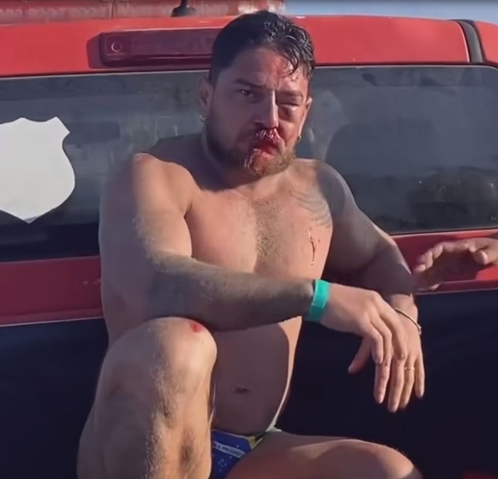 Casal de empresários é espancado em Porto de Galinhas Foto: Reprodução/Redes Sociais