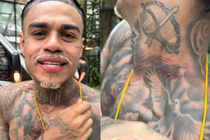 MC Cabelinho relata tentativa de assalto e mostra pescoço machucado Foto: Reprodução/Instagram/@mccabelinho