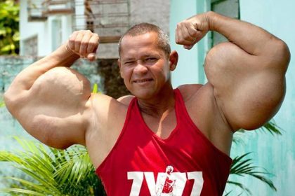 Arlindo de Souza, conhecido como "Popeye humano", falece aos 55 anos 10764821 arlindo de souza conhecido como popeye brasileiro 1