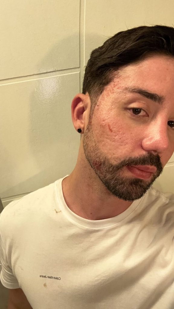 Rico Melquiades relata tentativa de agressão por ex-namorado SaveClip.App 610894581 18417449173188495 6891793091058482000 n