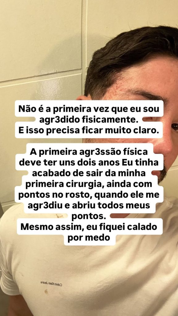 Rico Melquiades relata tentativa de agressão por ex-namorado Foto: Reprodução/Instagram @ricoof